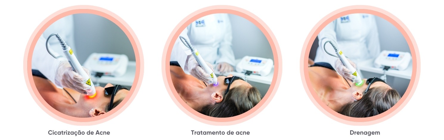 Laserpulse Portable Ibramed - estética