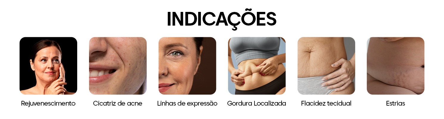 INDICAÇÕES ULTRAMED HIFU