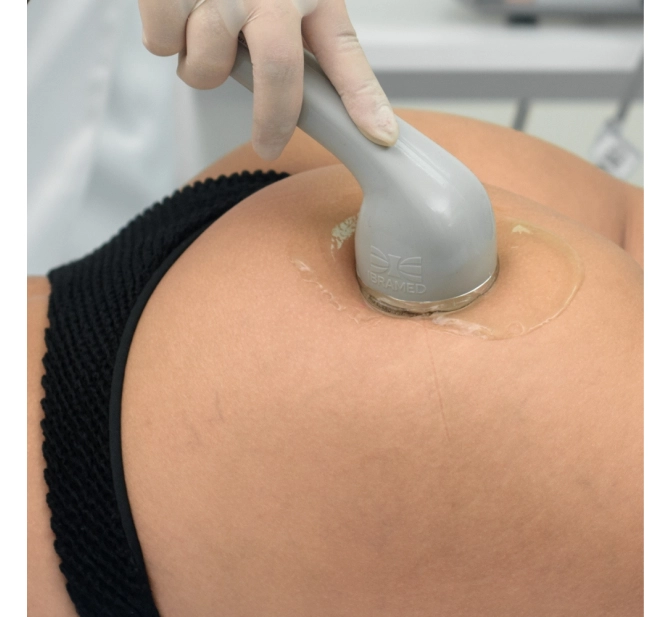 Sonopulse III - Aparelho Ultrassom 1 E 3 MHZ para Estética e Fisioterapia - IBRAMED